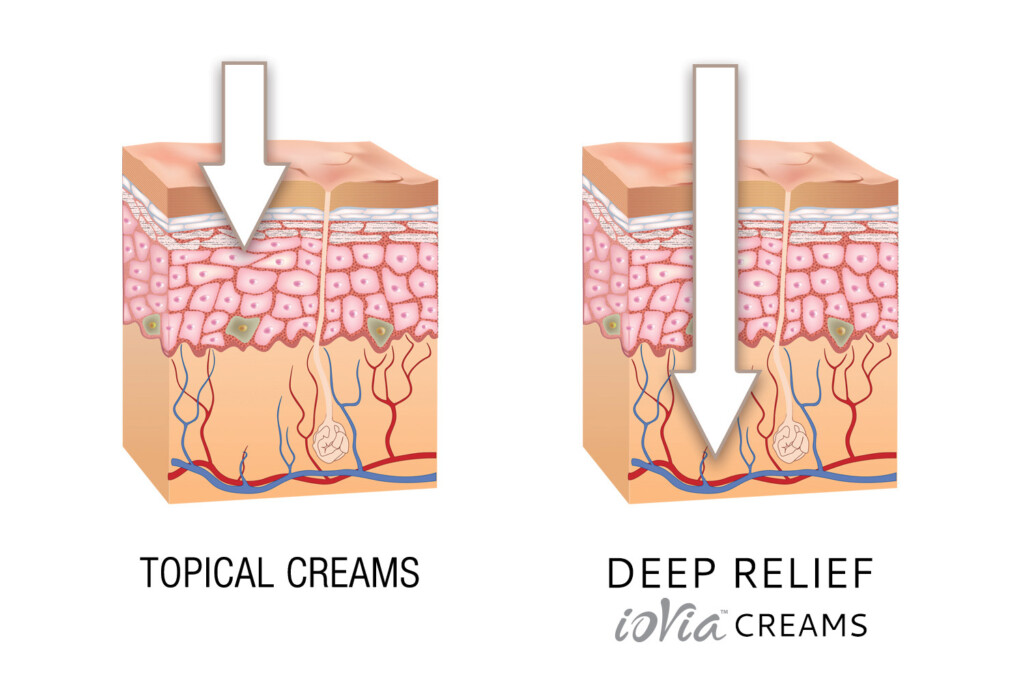 ioVia Deep Relief Cream Diagram